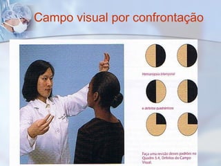Campo visual por confrontação
 