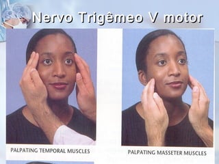 Nervo Trigêmeo V motorNervo Trigêmeo V motor
 
