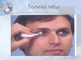 Coranial refluxCoranial reflux
 