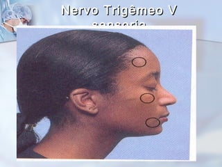 Nervo Trigêmeo VNervo Trigêmeo V
sensoriasensoria
 