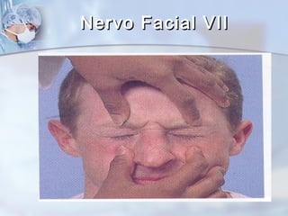 Nervo Facial VIINervo Facial VII
 