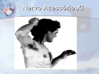 Nervo Acessório XINervo Acessório XI
 