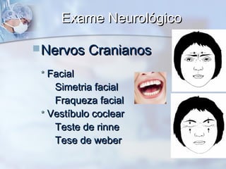 Exame NeurológicoExame Neurológico
Nervos CranianosNervos Cranianos
** FacialFacial
Simetria facialSimetria facial
Fraqueza facialFraqueza facial
** Vestíbulo coclearVestíbulo coclear
Teste de rinneTeste de rinne
Tese de weberTese de weber
 