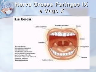 Nervo Grosso Faríngeo IXNervo Grosso Faríngeo IX
e Vago Xe Vago X
 
