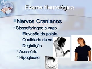 Exame NeurológicoExame Neurológico
Nervos CranianosNervos Cranianos
** Clossofaríngeo e vagoClossofaríngeo e vago
Elevação do palatoElevação do palato
Qualidade da vozQualidade da voz
DeglutiçãoDeglutição
** AcessórioAcessório
** HipoglossoHipoglosso
 