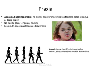 Semiologia Neurologica 3.ppt neurología clase | PPT