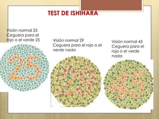 TEST DE ISHIHARA

Visión normal 25
Ceguera para el
rojo o el verde 25    Visión normal 29
                      Ceguera para el rojo o el
                      verde nada
 