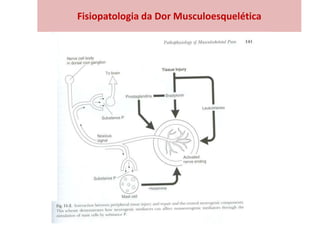 Fisiopatologia da Dor Musculoesquelética
 
