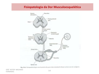 JOSÉ HEITOR MACHADO
FERNANDES
110
Fisiopatologia da Dor Musculoesquelética
 