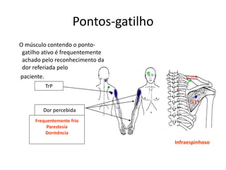 Pontos-gatilho
O músculo contendo o ponto-
gatilho ativo é frequentemente
achado pelo reconhecimento da
dor referiada pelo
paciente.
TrP
Dor percebida
Frequentemente frio
Parestesia
Dormência
Infraespinhoso
 