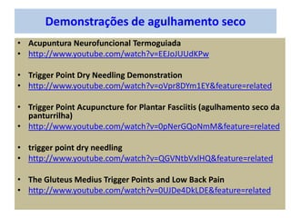 Demonstrações de agulhamento seco
• Acupuntura Neurofuncional Termoguiada
• http://www.youtube.com/watch?v=EEJoJUUdKPw
• Trigger Point Dry Needling Demonstration
• http://www.youtube.com/watch?v=oVpr8DYm1EY&feature=related
• Trigger Point Acupuncture for Plantar Fasciitis (agulhamento seco da
panturrilha)
• http://www.youtube.com/watch?v=0pNerGQoNmM&feature=related
• trigger point dry needling
• http://www.youtube.com/watch?v=QGVNtbVxlHQ&feature=related
• The Gluteus Medius Trigger Points and Low Back Pain
• http://www.youtube.com/watch?v=0UJDe4DkLDE&feature=related
 