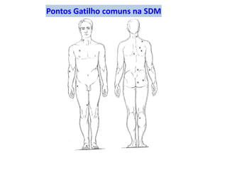Pontos Gatilho comuns na SDM
 