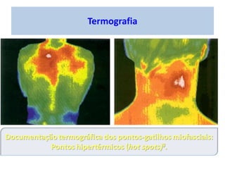 Termografia
 