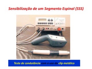 Sensibilização de um Segmento Espinal (SSS)
Teste de condutância com o uso do clip metálico
 
