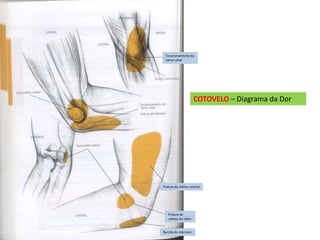 COTOVELO – Diagrama da Dor
Encarceramento do
nervo ulnar
Fratura da diáfise umeral
Fratura da
cabeça do rádio
Bursite do olécrano
 