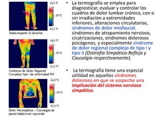 • La termografía se emplea para
diagnosticar, evaluar y controlar los
cuadros de dolor lumbar crónico, con o
sin irradiación a extremidades
inferiores, alteraciones circulatorias,
síndromes de dolor miofascial,
síndromes de atrapamiento nervioso,
cicatrizaciones, síndromes dolorosos
psicógenos, y especialmente síndrome
de dolor regional complejo de tipo I y
tipo II (Distrofia Simpático-Refleja y
Causalgia respectivamente).
• La termografía tiene una especial
utilidad en aquellos síndromes
dolorosos en que se sospeche una
implicación del sistema nervioso
simpático.
 