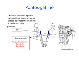 Pontos-gatilho
O músculo contendo o ponto-
gatilho ativo é frequentemente
achado pelo reconhecimento da
dor referiada pelo
paciente.
TrP
Dor percebida
Frequentemente frio
Parestesia
Dormência
Infraespinhoso
 