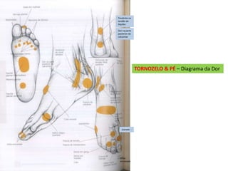 TORNOZELO & PÉ – Diagrama da Dor
Tendinite no
tendão de
Aquiles
Dor na parte
posterior do
calcanhar
Joanete
Unha
encravada
 