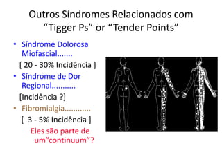 Outros Síndromes Relacionados com
“Tigger Ps” or “Tender Points”
• Síndrome Dolorosa
Miofascial.......
[ 20 - 30% Incidência ]
• Síndrome de Dor
Regional...........
[Incidência ?]
• Fibromialgia............
[ 3 - 5% Incidência ]
Eles são parte de
um”continuum”?
 