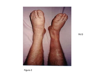 Figura 2
Pé D
 