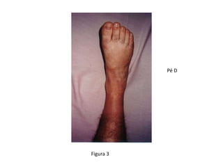 Figura 3
Pé D
 