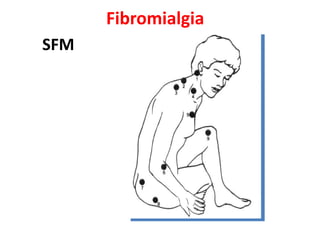 Fibromialgia
SFM
 