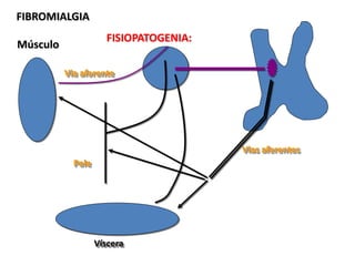 FIBROMIALGIA
Pele
Músculo
Víscera
Vias aferentes
Via aferente
FISIOPATOGENIA:
 