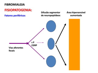 FIBROMIALGIA
FISIOPATOGENIA:
Fatores periféricos
Vias aferentes
focais
s P
CGRP
Difusão segmentar
de neuropeptídeos
Área hipersensível
aumentada
 