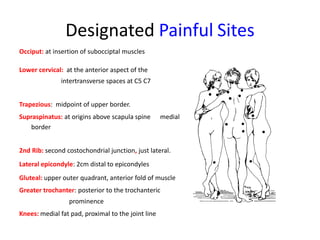 Designated Painful Sites
Occiput: at insertion of subocciptal muscles
Lower cervical: at the anterior aspect of the
intertransverse spaces at C5 C7
Trapezious: midpoint of upper border.
Supraspinatus: at origins above scapula spine medial
border
2nd Rib: second costochondrial junction, just lateral.
Lateral epicondyle: 2cm distal to epicondyles
Gluteal: upper outer quadrant, anterior fold of muscle
Greater trochanter: posterior to the trochanteric
prominence
Knees: medial fat pad, proximal to the joint line
 