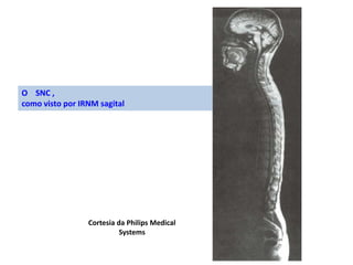 O SNC ,
como visto por IRNM sagital
Cortesia da Philips Medical
Systems
 