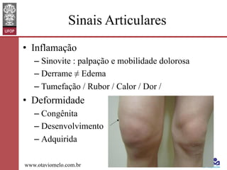Sinais Articulares
•  Inflamação
–  Sinovite : palpação e mobilidade dolorosa
–  Derrame ≠ Edema
–  Tumefação / Rubor / Calor / Dor /

•  Deformidade
–  Congênita
–  Desenvolvimento
–  Adquirida
www.otaviomelo.com.br

 