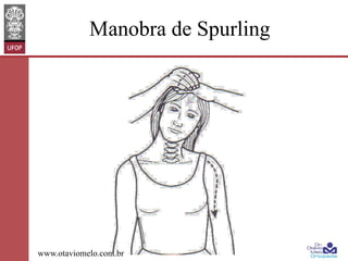 Manobra de Spurling

www.otaviomelo.com.br

 