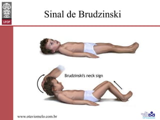 Sinal de Brudzinski

www.otaviomelo.com.br

 