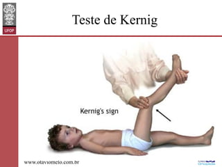 Teste de Kernig

www.otaviomelo.com.br

 