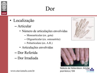 Dor
•  Localização
–  Articular
•  Número de articulações envolvidas
–  Monoarticular (ex. gota)
–  Oligoarticular (ex. osteoartrite)
–  Poliarticulare (ex. A.R.)

•  Articulações envolvidas

–  Dor Referida
–  Dor Irradiada
www.otaviomelo.com.br

Nódulo	
  de	
  Heberdeen:	
  Artrite	
  
psoriásica	
  /	
  OA	
  	
  

 