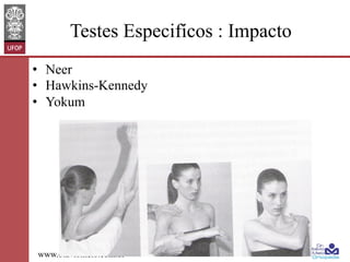 Testes Especifícos : Impacto
•  Neer
•  Hawkins-Kennedy
•  Yokum

www.otaviomelo.com.br

 