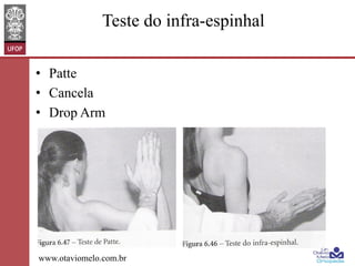 Teste do infra-espinhal
•  Patte
•  Cancela
•  Drop Arm

www.otaviomelo.com.br

 