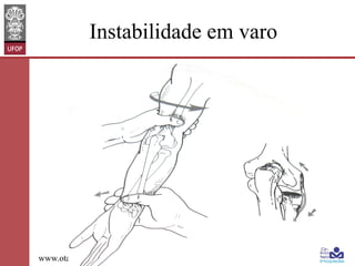 Instabilidade em varo

www.otaviomelo.com.br

 