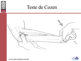 Teste de Cozen

www.otaviomelo.com.br

 