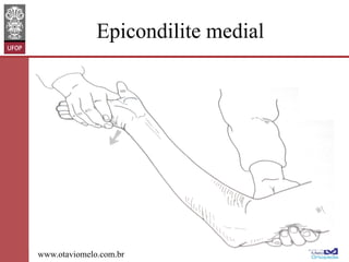 Epicondilite medial

www.otaviomelo.com.br

 