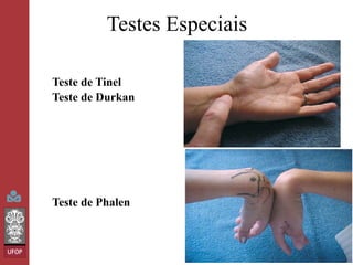 Testes Especiais
Teste de Tinel
Teste de Durkan

Teste de Phalen

 