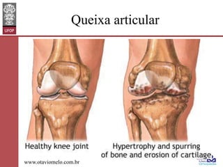 Queixa articular

www.otaviomelo.com.br

 