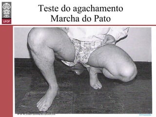 Teste do agachamento
Marcha do Pato

www.otaviomelo.com.br

 