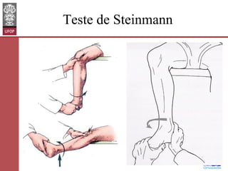 Teste de Steinmann

www.otaviomelo.com.br

 