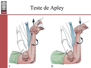 Teste de Apley

www.otaviomelo.com.br

 