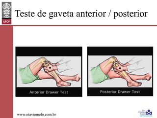 Teste de gaveta anterior / posterior

www.otaviomelo.com.br

 