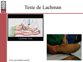 Teste de Lachman

www.otaviomelo.com.br

 