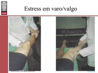 Estress em varo/valgo

www.otaviomelo.com.br

 