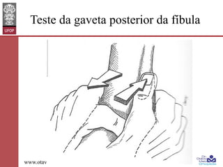 Teste da gaveta posterior da fíbula

www.otaviomelo.com.br

 