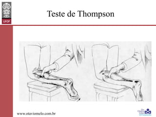 Teste de Thompson

www.otaviomelo.com.br

 